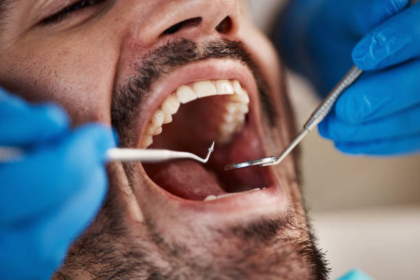 Best Emergency Treatment for Toothache in Bradford, PA
